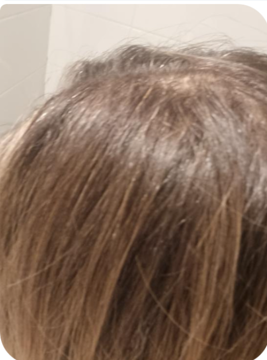 שיער לאחר שימוש במוצרי CarolineHair